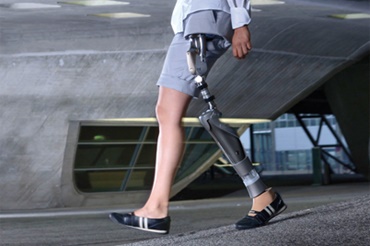 Hip joint prosthesis with iglidur bearings by Otto Bock HealthCare GmbH